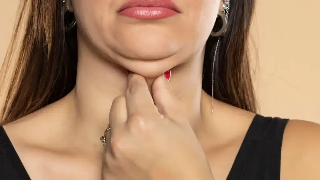 An image of a woman with double chin, sad, worried : Non Surgical Double Chin Removal Treatment in Swadlincote, UK