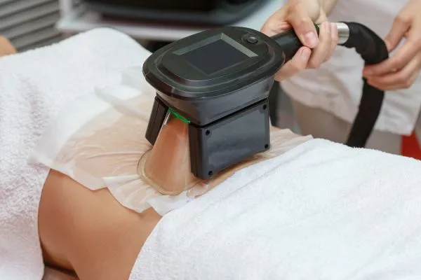 Image of person having fat freezing treatment to help weight gain Swadlincote