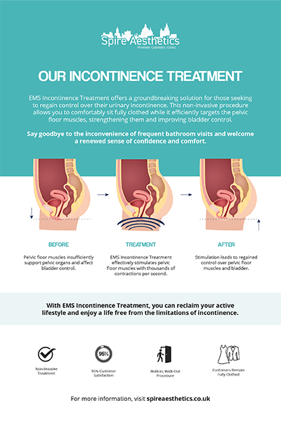 image to show how EMS treatment works for female urinary incontinence Swadlincote