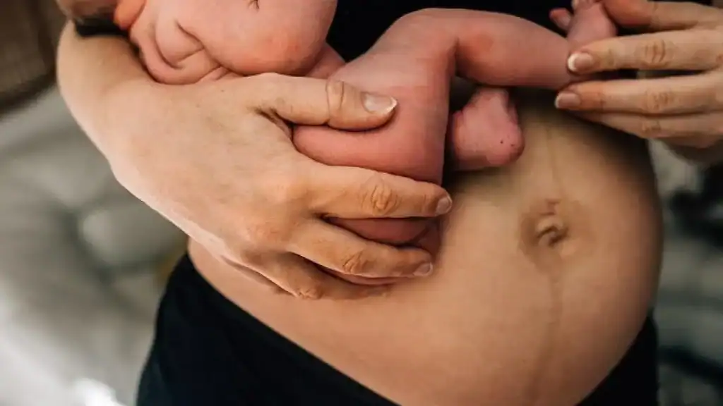 Why Is My Stomach Still Big After Pregnancy Swadlincote?